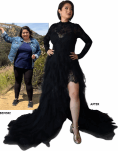 before and after gastric sleeve women​