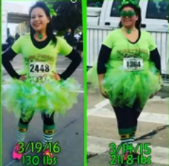 before and after gastric sleeve women​