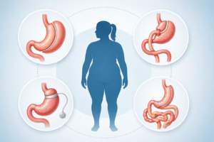 Weight Loss Surgery Options