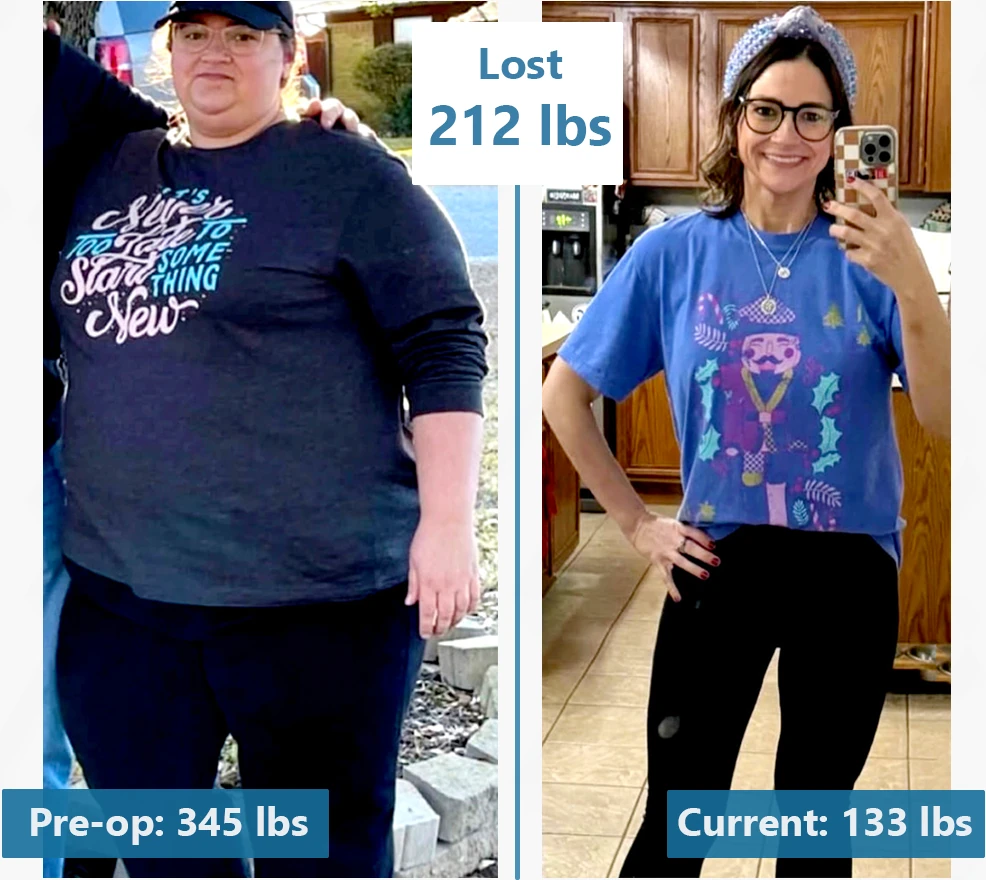Before-and-after photographs of a BodEvolve patient, labeled 345 lbs before and 133 lbs after.